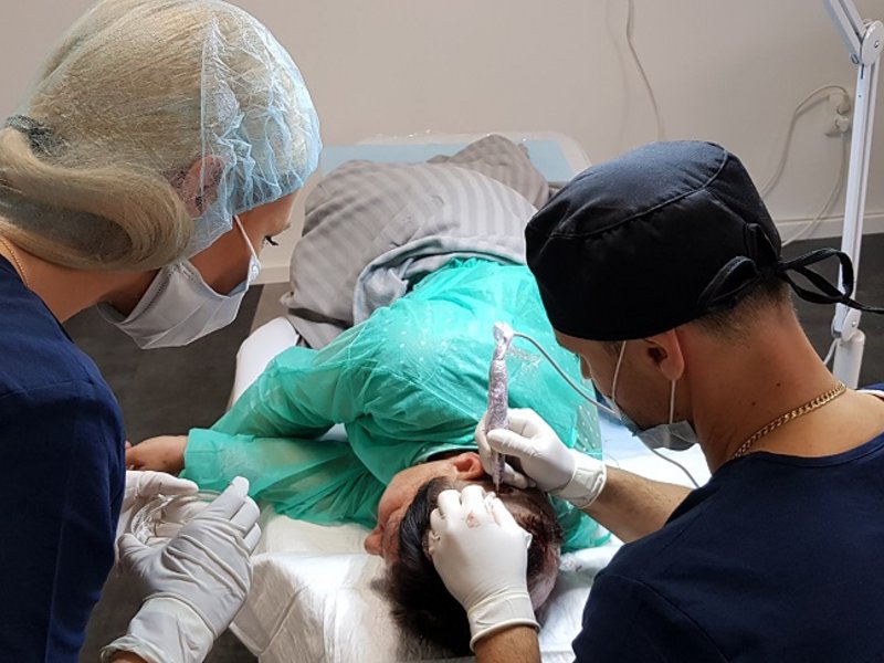 FUE Transplantacija kose je metoda premeštanaja/ekstrakcija kose sa sigurne, davajuće regije u regije gde je kosa proređena ili bez kose. Praktikuje se kod oba pola kao tretman raznih oblika gubitka kose. FUE ili ekstrakcija folikularne jedinice, poznata i kao folikularni transfer - FT. 